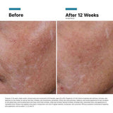 SkinCeuticals - Hyaluronic Acid (HA) Intensifier Multi-Glycan
