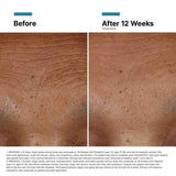 SkinCeuticals - Hyaluronic Acid (HA) Intensifier Multi-Glycan