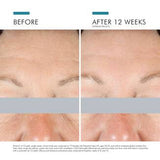 SkinCeuticals - A.G.E. Eye Advanced