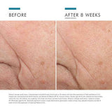 SkinCeuticals - Triple Lipid Restore 2:4:2