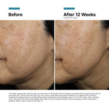 SkinCeuticals - A.G.E. Interrupter Ultra Serum