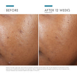 SkinCeuticals - Phyto A+ Brightening Treatment