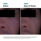 SkinCeuticals - P-TIOX Cream